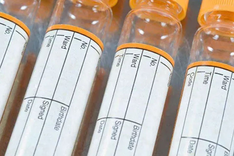 What is label paper？
